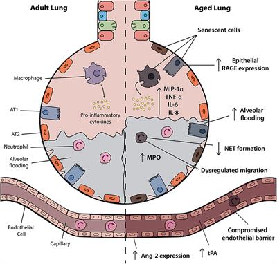 The Impact of Aging in Acute Respiratory Distress Syndrome: A Clinical and Mechanistic Overview